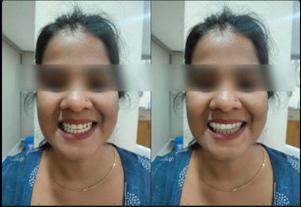Two views of a smile