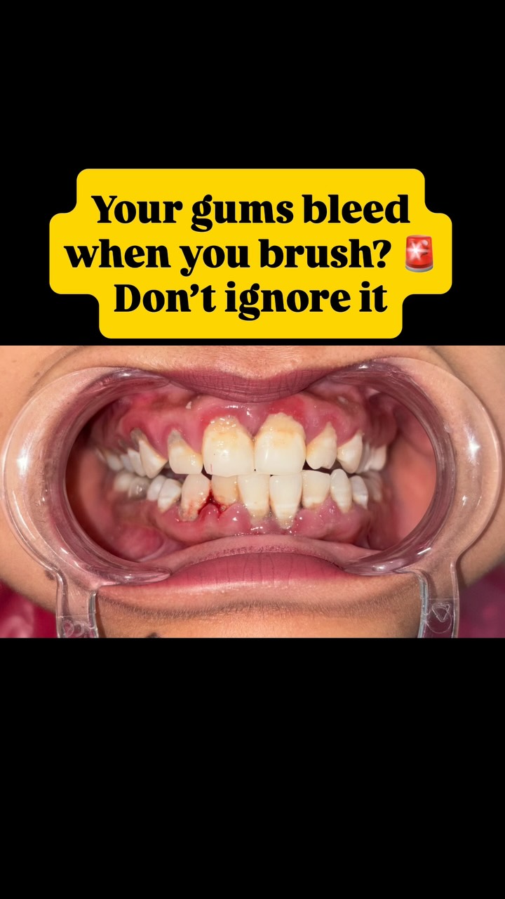 Gum care reel